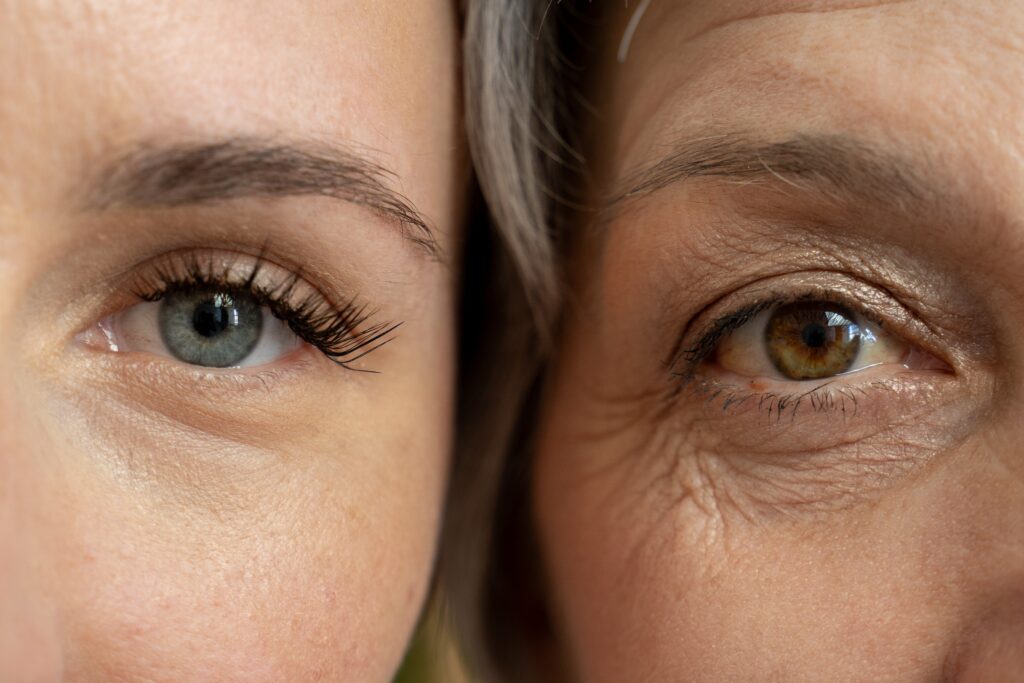 Close-up comparison of younger and older eyes illustrating the visible effects of aging and the role of NAD+ therapy in supporting healthy aging and cellular wellness.