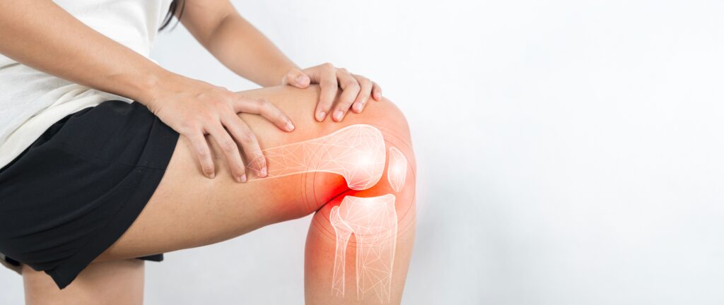 Can Peptides Help With Recovery After Knee Replacement?