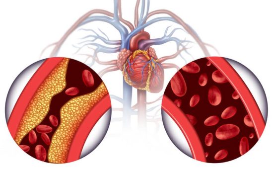 Chelation therapy and heart disease treatment concept as an alternative medicine for human blood circulation disease with 3D illustration elements.